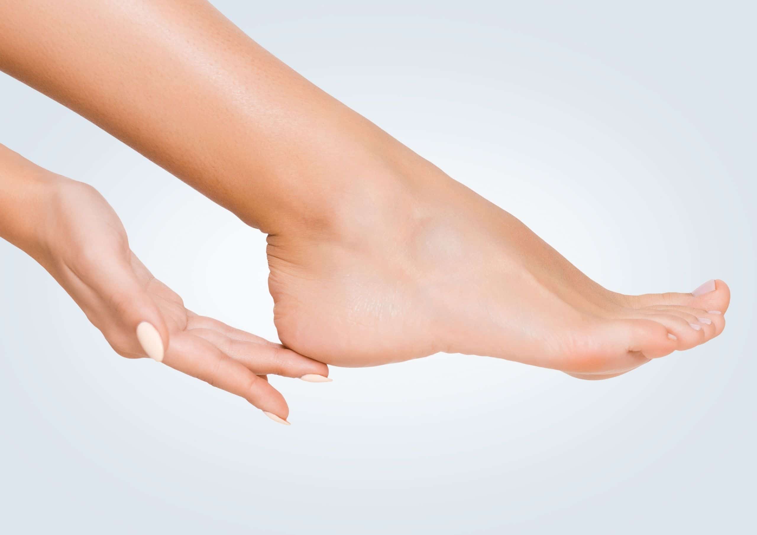 Methods of treating cracked feet and preventing cracked feet