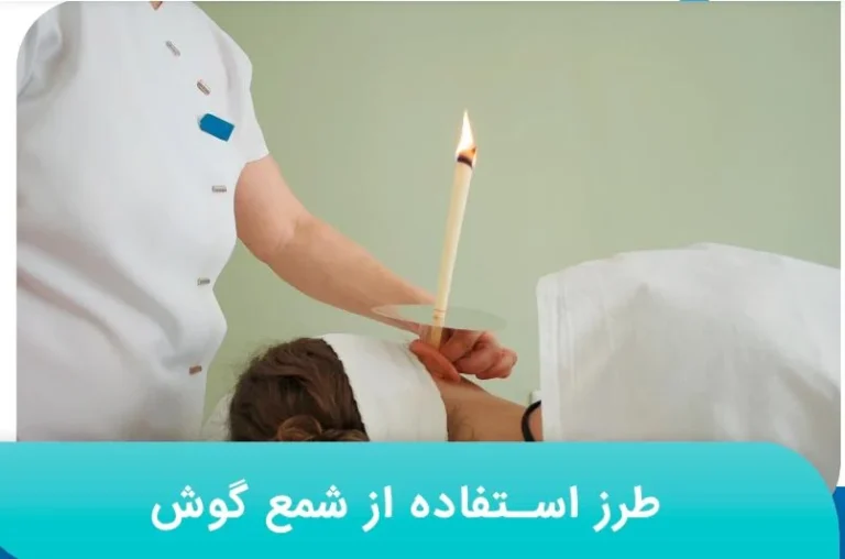 همه نکات مهم در مورد شمع گوش توسط دکتر فرامرز معماری