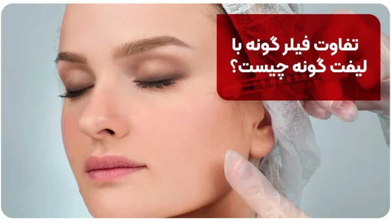 تفاوت فیلر گونه با لیفت گونه چیست؟