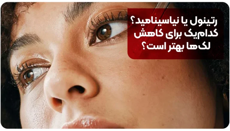 رتینول یا نیاسینامید؟ کدام‌یک برای کاهش لک‌ها بهتر است؟