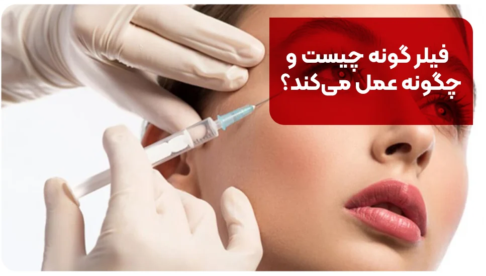 فیلر گونه چیست و چگونه عمل میکند؟