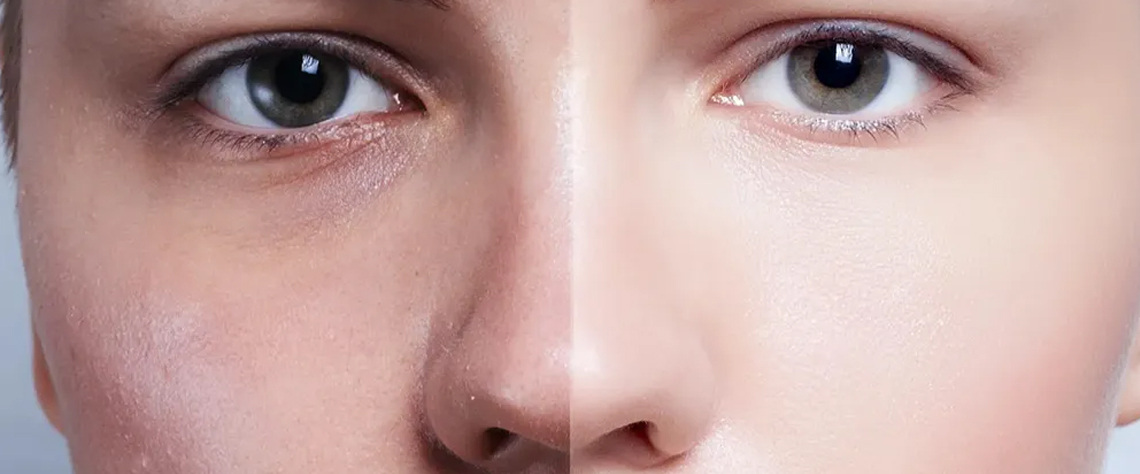 تجربه واقعی کاربران از سرم سیلکر