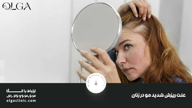 علت ریزش شدید مو در زنان چیست؟