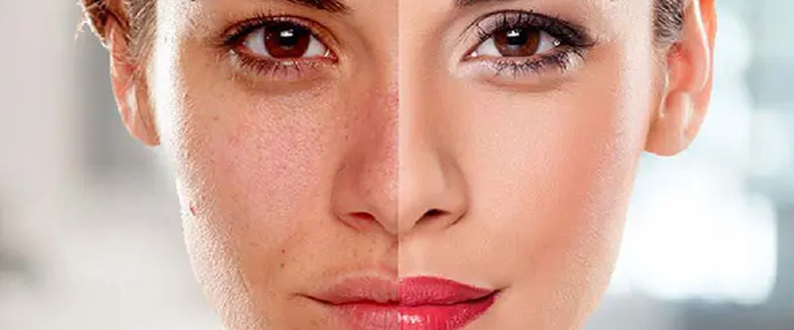 نحوه سفارش و تحویل سریع سرم سیلکر